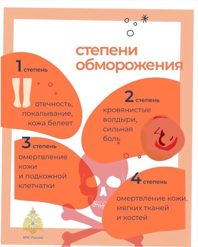 В первые дни зимы напоминаем о правилах безопасности в морозы