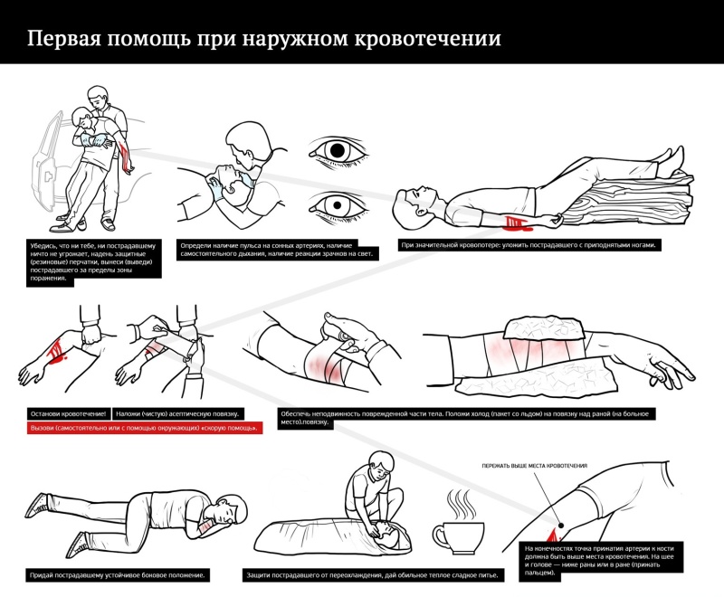 Первая помощь
